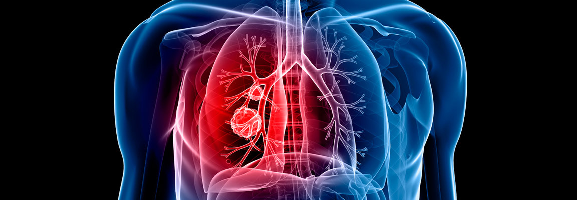 COPD Genetik