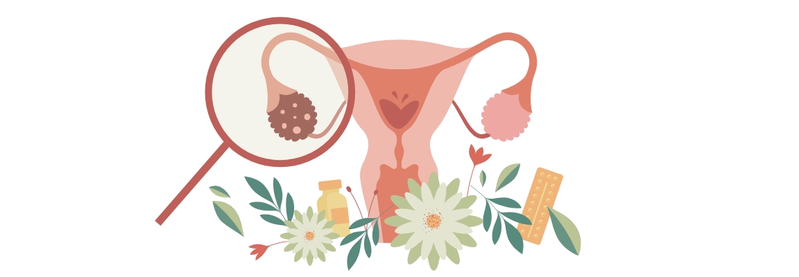 Ovarian Cancer, subtle but lethal