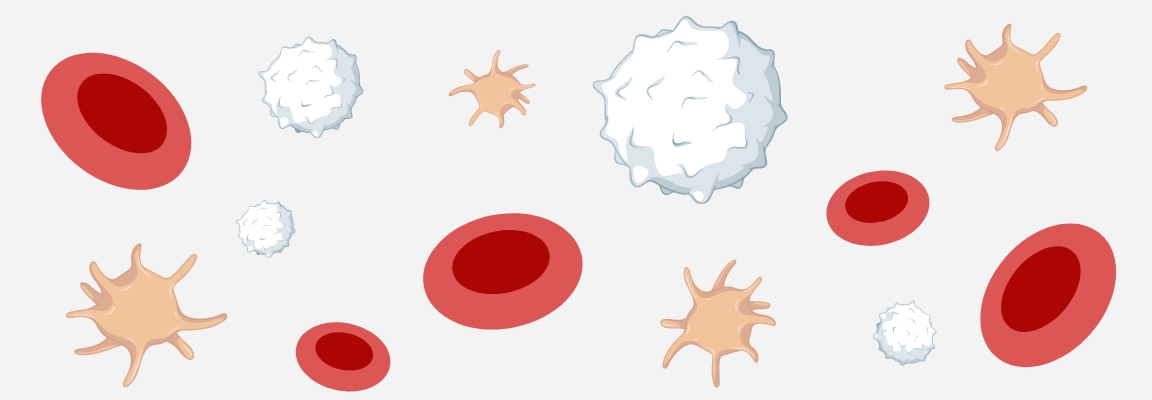 Neoplasie mieloproliferative, troppe cellule nel sangue