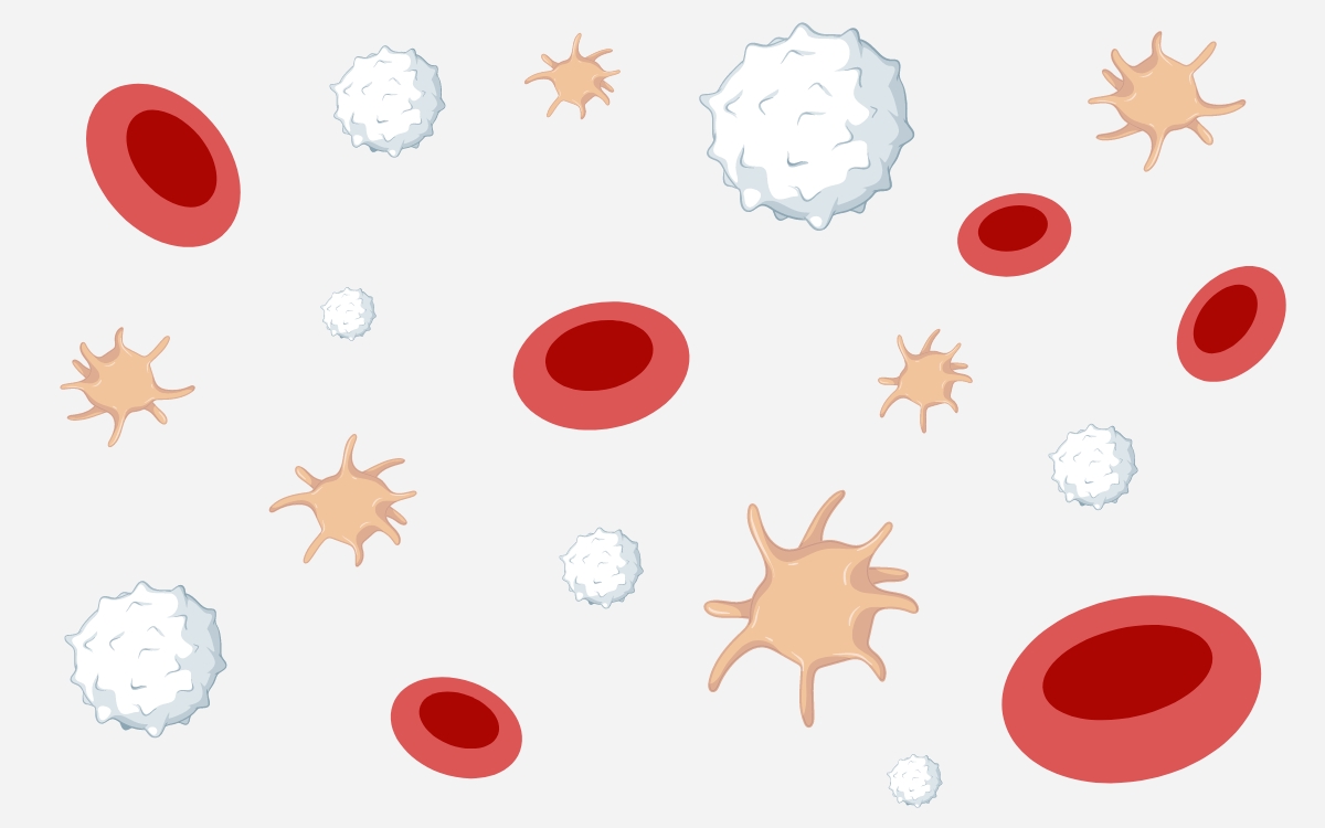 Myeloproliferative neoplasms, too many cells in the blood